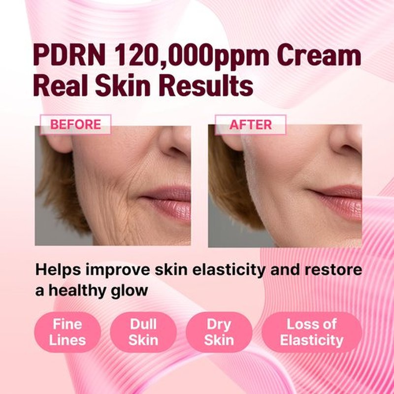 CELDYQUE PDRN 120,000 ppm EGF Peptide Cream – Volufiline & Salmon DNA + 12% Phyto PDRN – Post Microneedling Aftercare Anti-Aging Face Cream w/Niacinamide & Hyaluronic Acid 1.7 oz