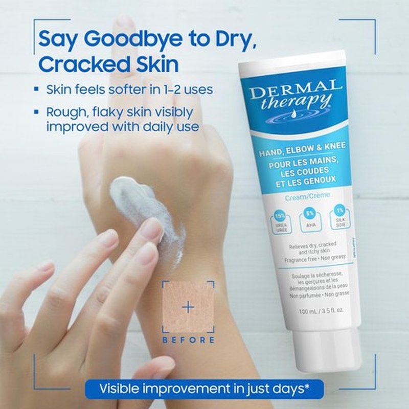 Dermal Therapy Hand Elbow & Knee Cream with 15% Urea & 6% AHA - Deeply Hydrates & Exfoliates Dry, Cracked Skin on Hands, Elbows & Knees - Fragrance-Free, Non-Greasy - 3.5 fl oz / 100 ml