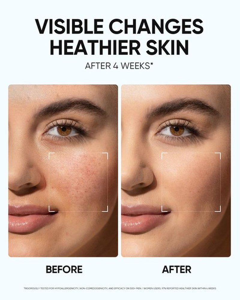 SKINTIFIC Face Moisturizer with 5X Ceramides, Hydrating Moisture Barrier Repair Cream for Sensitive/Oil Skin Types, Hyaluronic Acid & Centella, Daily Facial Moisturizer, Non-Comedogenic 30g/1 fl.oz