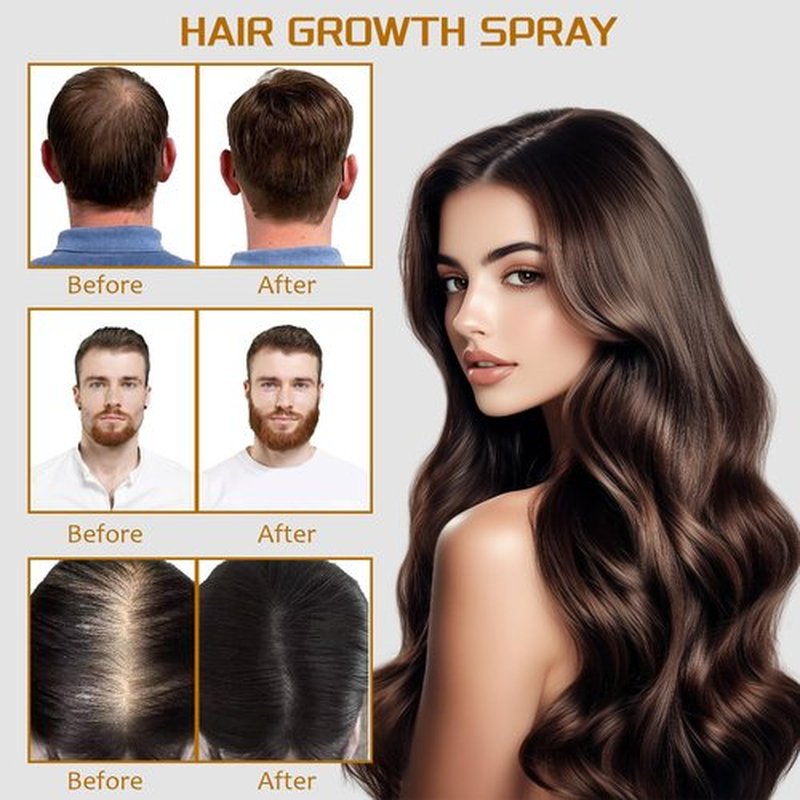 5% Minoxidil Spray with Biotin - Regrowth Treatment for Men Women, Promotes Thicker, Stronger, Fuller Hair, Prevents Hair Loss, for Men Hair & Beard, for Women Hair Growth, 3.38 oz
