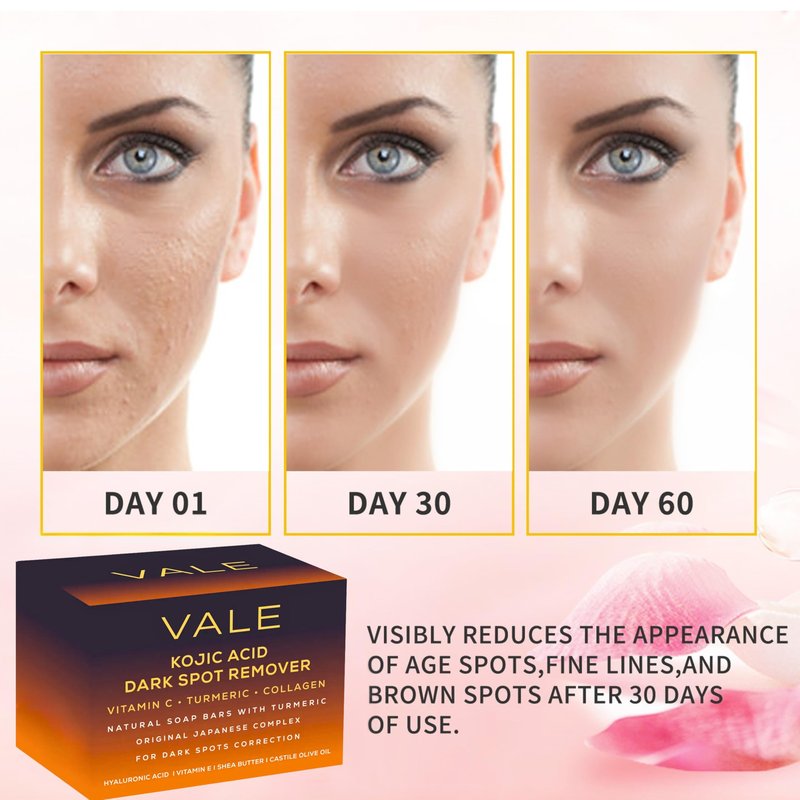VALE Kojic Acid & Turmeric Soap Bars (3-Pack) – Natural Dark Spot Remover & Original Japanese Complex with Vitamin C, E, Collagen, Retinol, Olive Oil & Shea Butter(Citrus)