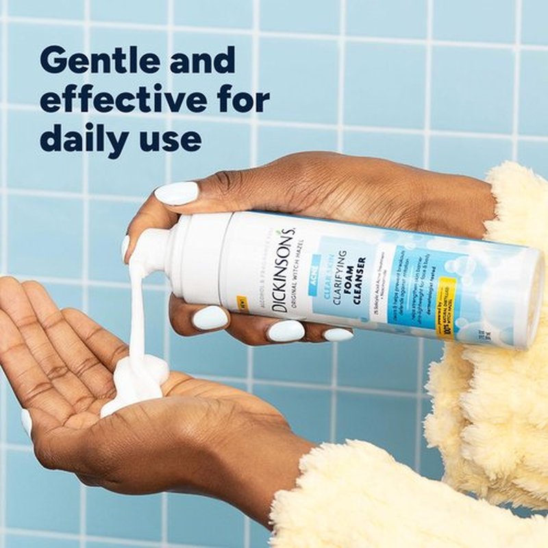Dickinson’s Witch Hazel Acne Foam Cleanser - 2% Salicylic Acid & Niacinamide | Alcohol-Free Daily Face Wash | 7 Fl Oz