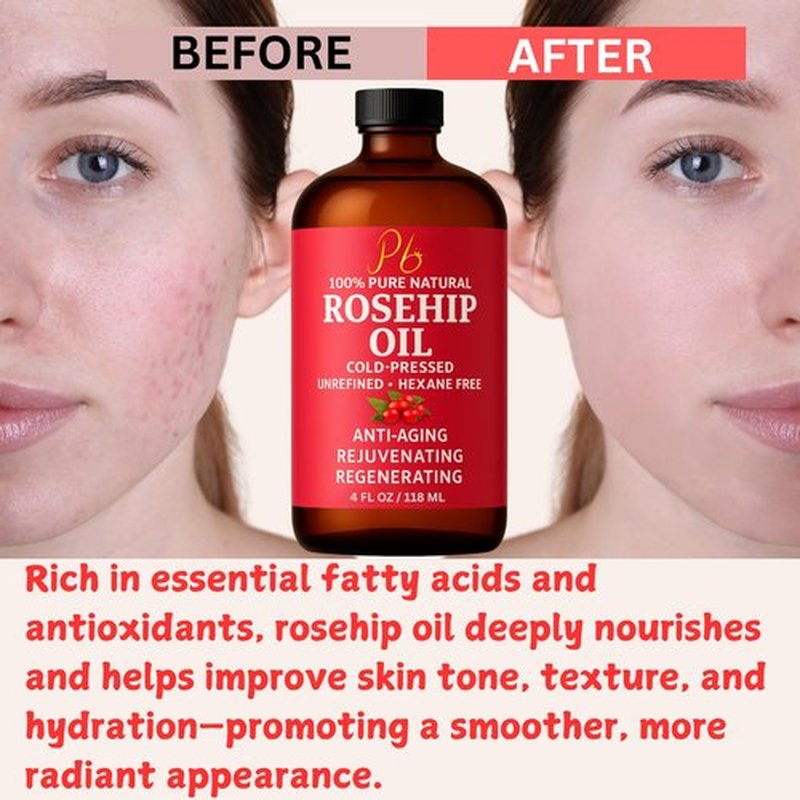 Pomberries Rosehip Seed Oil – Cold-Pressed & Unrefined, Rosehip Oil for Face, Skin & Hair – Rose Hip oil for Scars, Wrinkles, Stretch Marks, Daily Hydration & Gua Sha Massage, 4 fl oz