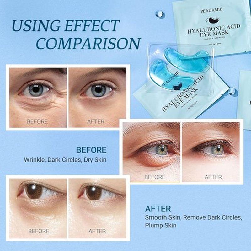 PEAUAMIE Under Eye Patches - Hyaluronic Acid Mask for Dark Circles & Puffiness | 30 Pairs