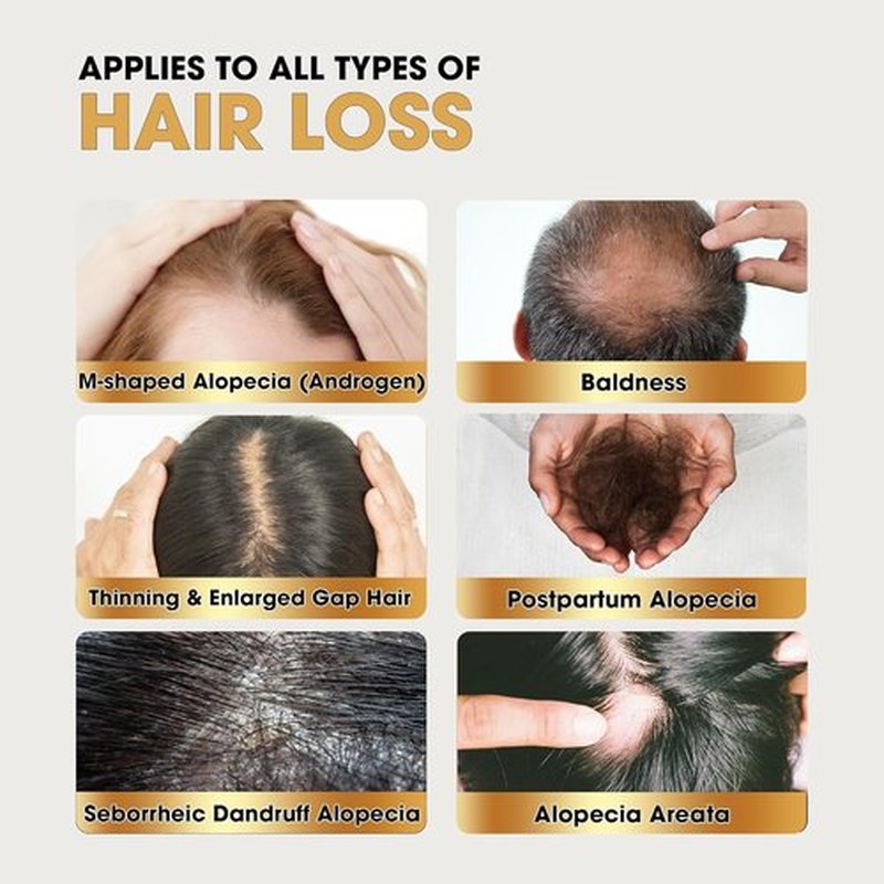 Herb Hair Growth Oil Spray - Strengthening Serum for Dry Scalp & Thinning Hair Regrowth