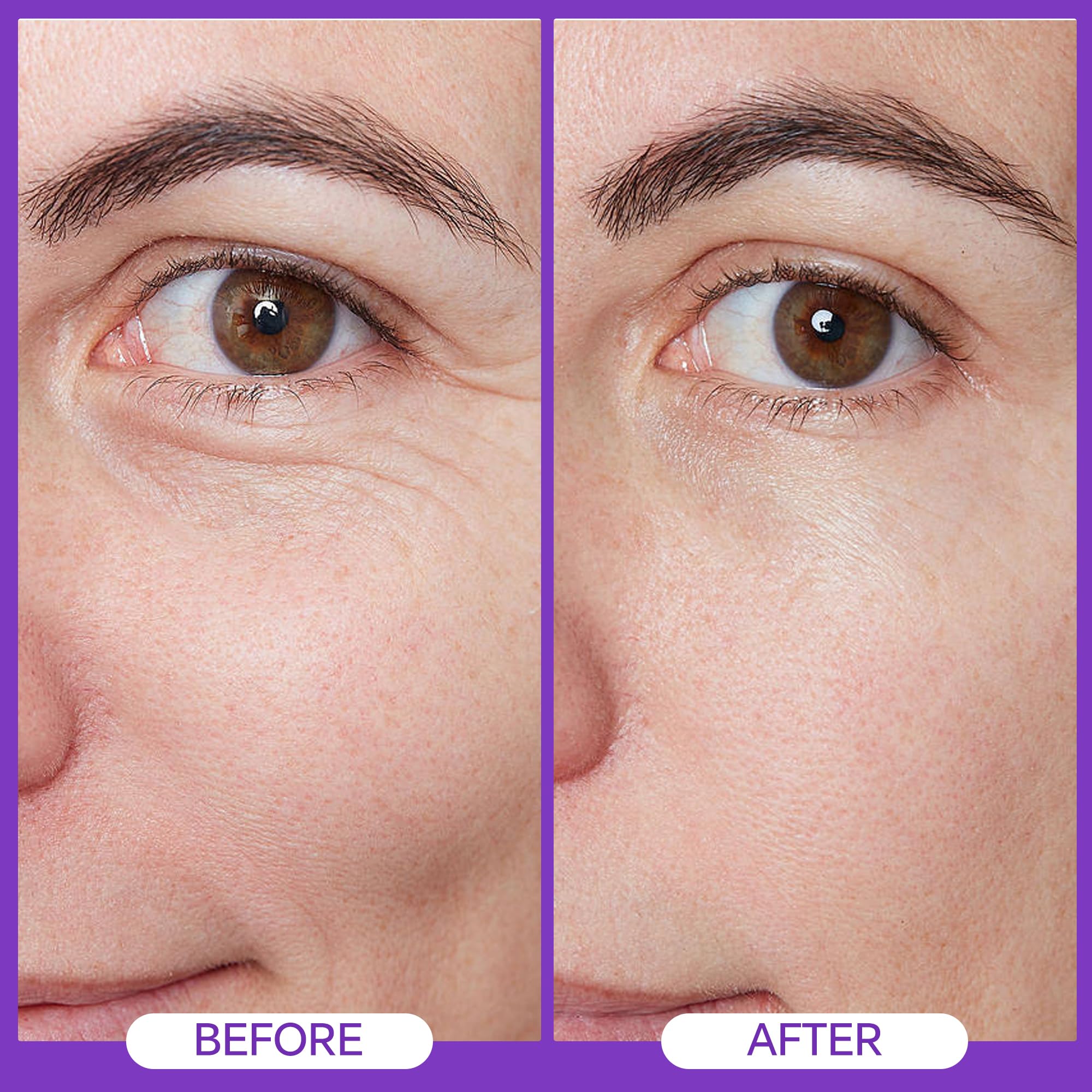 MegustaMe Eye Repair Cream 15ml - Peptide Complex Eye Cream with 3 Essential Ceramides, Niacinamide & Hyaluronic Acid, Dermatologist Developed Anti-Aging Eye Treatment for Fine Lines, Dark Circles.