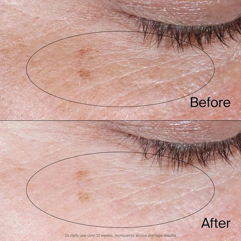 Neutrogena Collagen Bank Eye Cream - Revitalize Under Eyes, Reduce Dark Circles & Puffiness | 0.5 oz