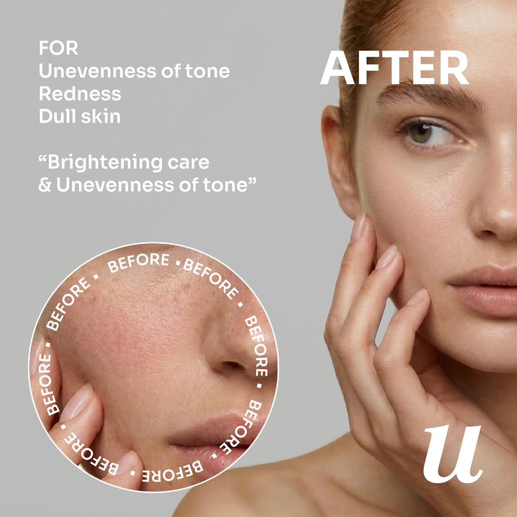 uLOOK Even Tone Serum 30 mL / 1.01 fl oz – Niacinamide, Azelaic Acid & Licorice Root Extract – Uneven Tone Support – Flora Friendly