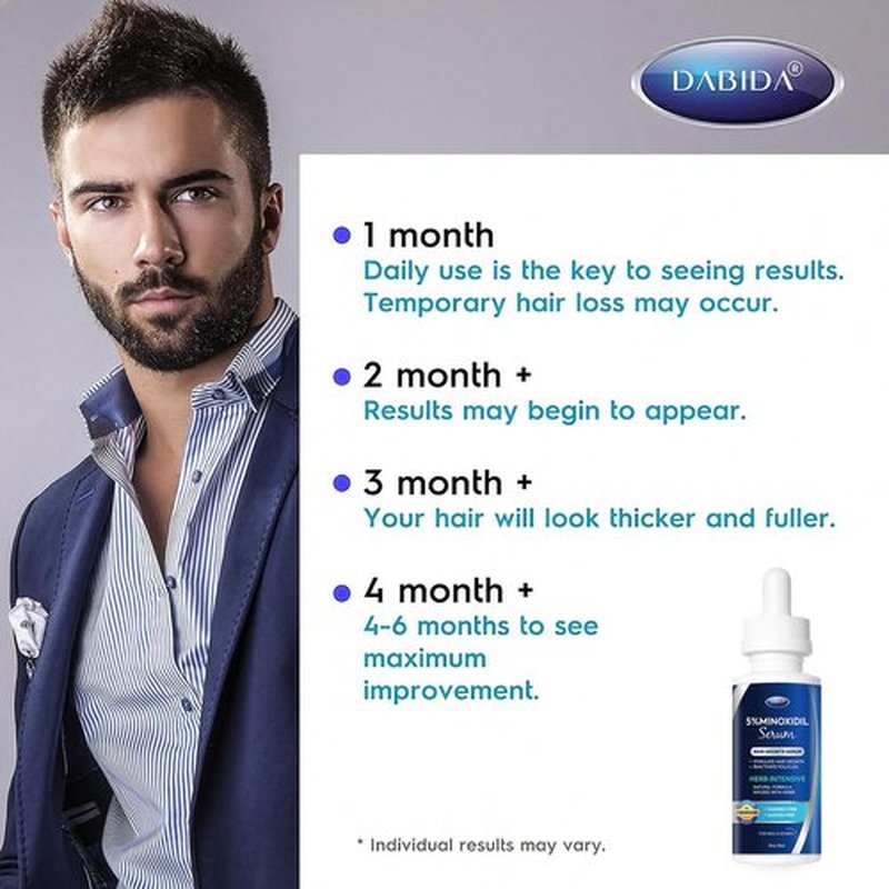 5% Minoxidil Hair Growth for Men and Women: Extra Strength Minoxidil and Biotin Beard Regrowth Serum for Thinning Hair Loss to Grow Thicker Fuller Hair 60ml 4 Bottles