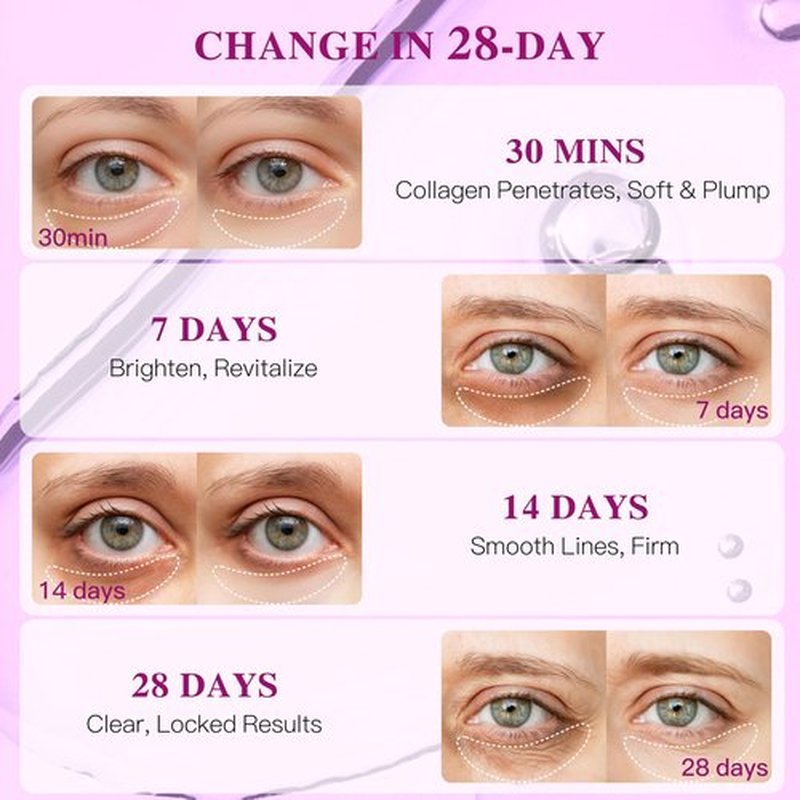 ICIKOL Collagen Under Eye Patches Mask - Undereye Patches for Dark Circles, Puffiness, Wrinkles - Gel Under Eye Patches, Birthday Gifts for Women - Gifts for Women - Vegan