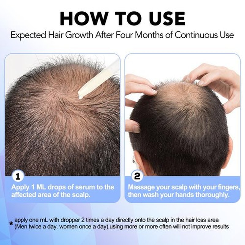 Minoxidil for Men-5% Extra Strength Hair Regrowth for Men Treatment-5% Topical Solution-Dropper Applicator Included -Minoxidil for Women-Stop Thinning & Hair Loss (1pcs