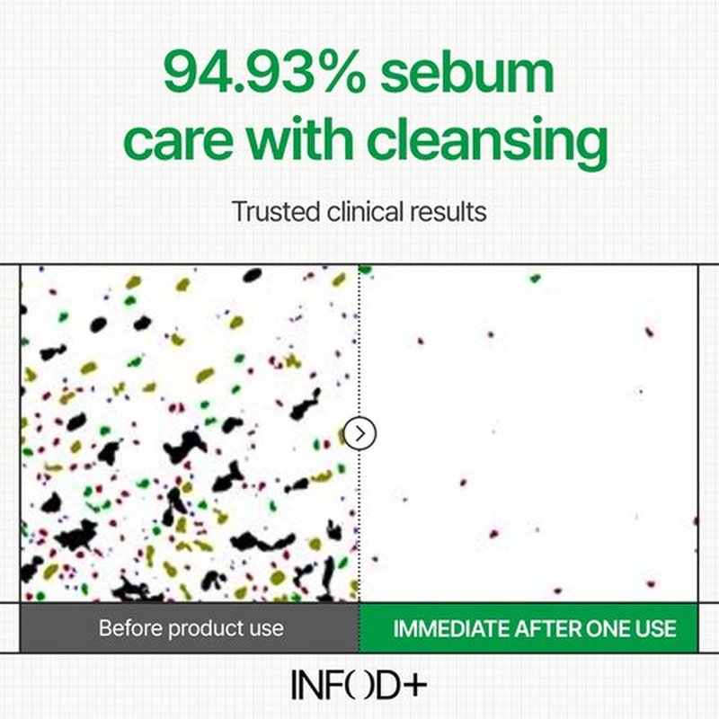 INFODPLUS XCESPI316 Gel Cleanser – Exosome & Walnut Powder Foaming Face Wash for Deep Pore Cleansing, Oil Control & Blackhead Care | Korean Cleanser for Men & Women, 100ml