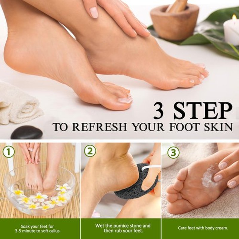 Natural Pumice Stone for Feet - Lava Foot Scrubber Dead Skin Corn Callus Remover Exfoliator Pedicure Tools for Feet Heels and Hands 2 Pack