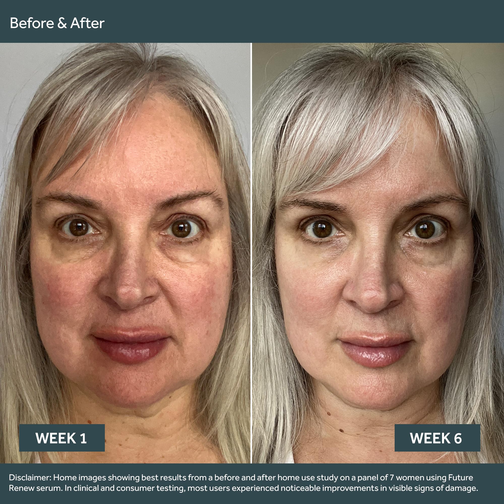 No7 Future Renew Duo - Includes Future Renew Face Serum (15ml) & Future Renew Night Cream (50ml) - Peptide Technology to Reverse Visible Signs of Damaged Skin (2 Count)