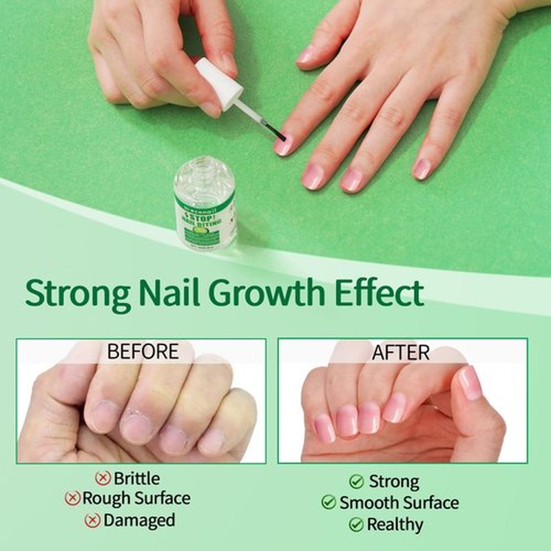 Econail Nail Biting Treatment For Kids, Nail Biting Prevention, No Bite Nail Care, Thumb Sucking Deterrent For Ages 3+, 0.5 fl oz (10ml)