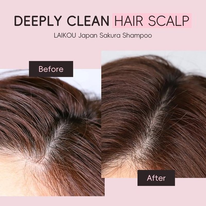Sakura Shampoo, 14oz Clarifying, Hydrating and Thickening Hair Care, Repairs, Shine, Strengthens Volumizing Japanese Cherry Blossoms Vegan Shampoo for Dry Damaged Hair Care & Scalp Exfoliation, Pink