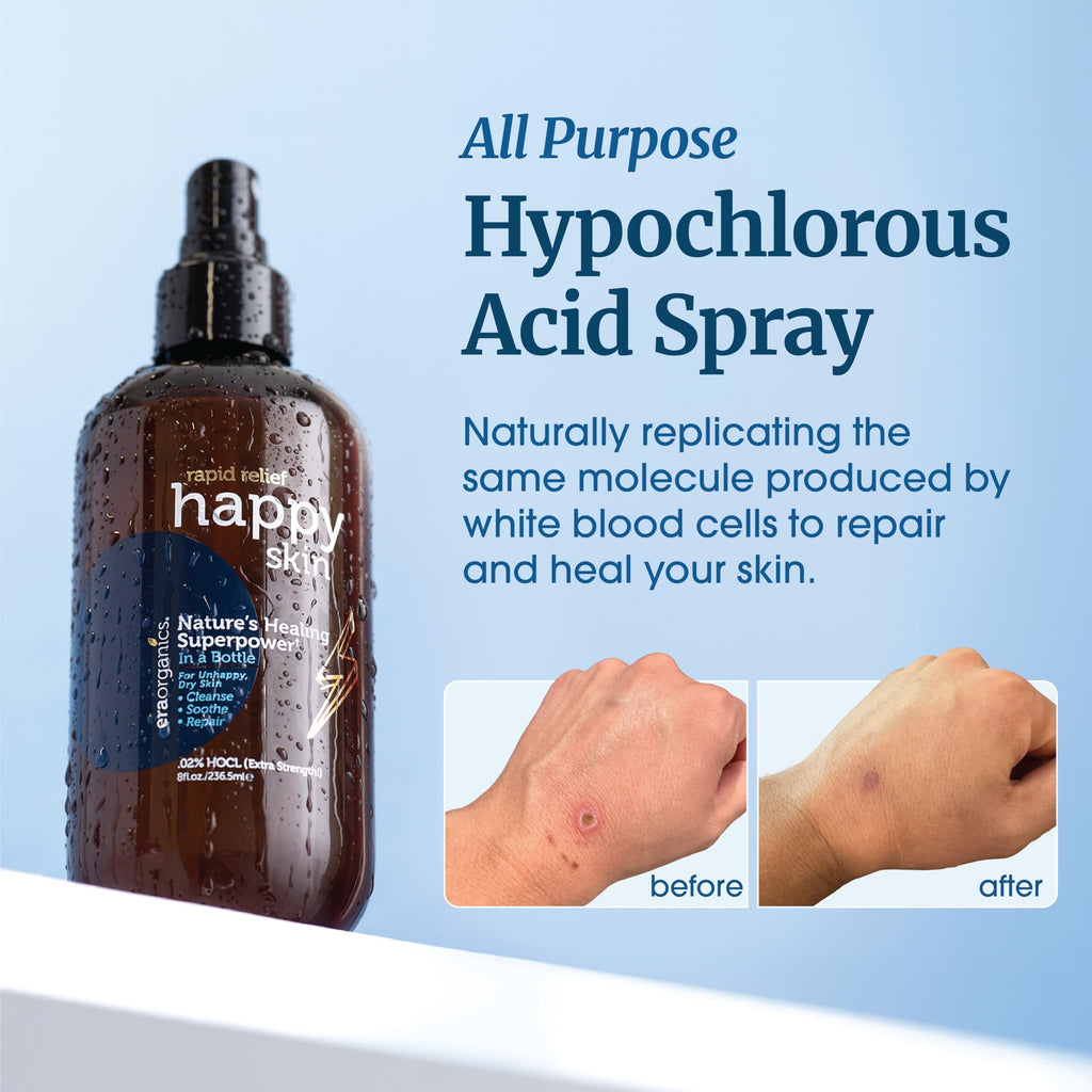 Happy Skin .02% Hypochlorous Acid Spray Toner– Extra Strength, Extra Gentle 100% Natural Toner & Skin Cleanser for Face & Body– Soothe, Hydrate & Repair Dry, Sensitive Skin– pH Balanced, Non-Toxic 8oz