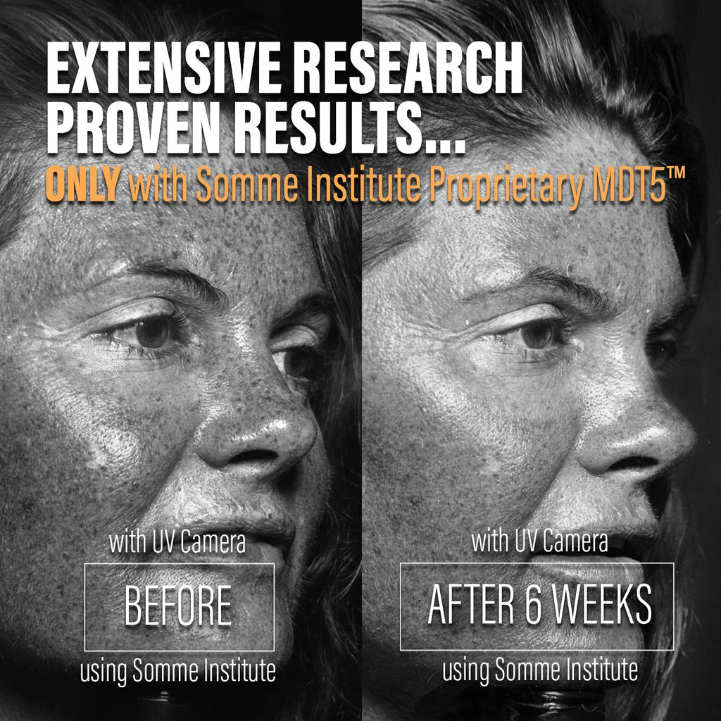 Somme Institute Pore Minimizer Face Mask | Detoxifying, Anti-Aging Clay Mask | Acne Face Mask | Natural Skincare | Deep Hydration