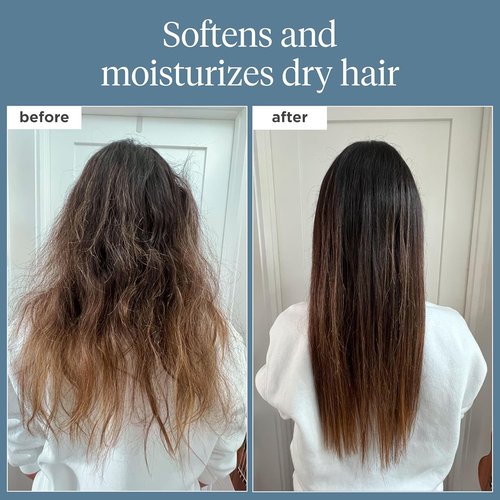 Briogeo Scalp Revival Rosemary Pre-Wash Oil - Moisturizing Treatment for Dry, Flaky Scalp | Strengthens Hair & Soothes Itchiness | Vegan & Cruelty-Free