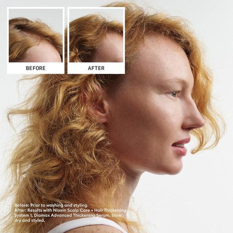 Nioxin System 1 Scalp & Hair Thickening Conditioner - Strengthen Natural Hair with Niacinamide & Biotin | Refreshing Shine