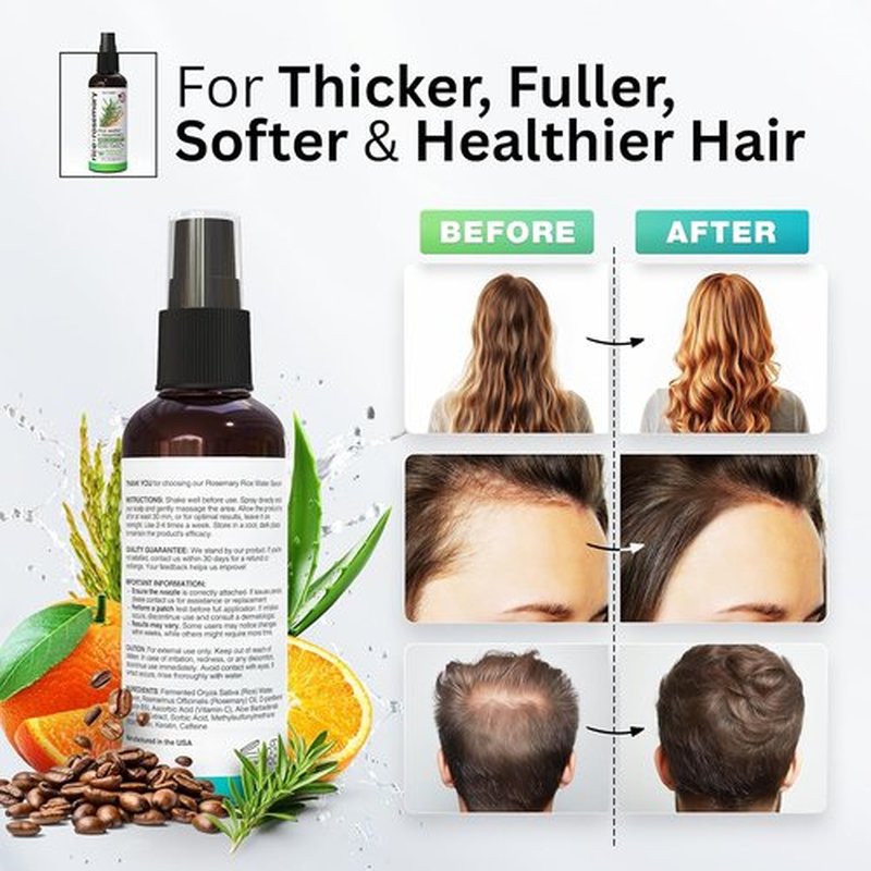 Fermented Rice Water Hair Growth Spray by NEW | Boost Thinning Hair with Rosemary, Biotin & Caffeine | All Hair Types