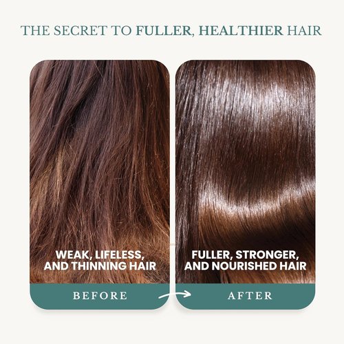 Edenika Botanicals Rosemary Oil Shampoo - Biotin Formula for Thinning Hair | Sulfate-Free, 16 fl oz