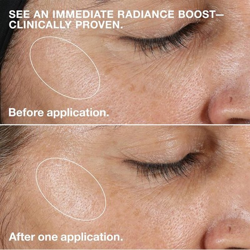 Clinique 3-Step Clarifying Lotion - Exfoliating Toner With Witch Hazel & Salicylic Acid | For Very Dry Skin