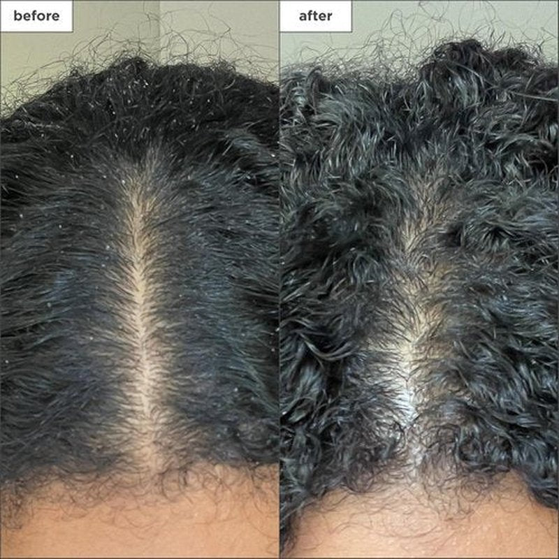 Briogeo Scalp Revival Charcoal Shampoo - Sulfate-Free Micro-Exfoliating Scalp Scrub | Detox & Hydrate Dry, Itchy Scalp