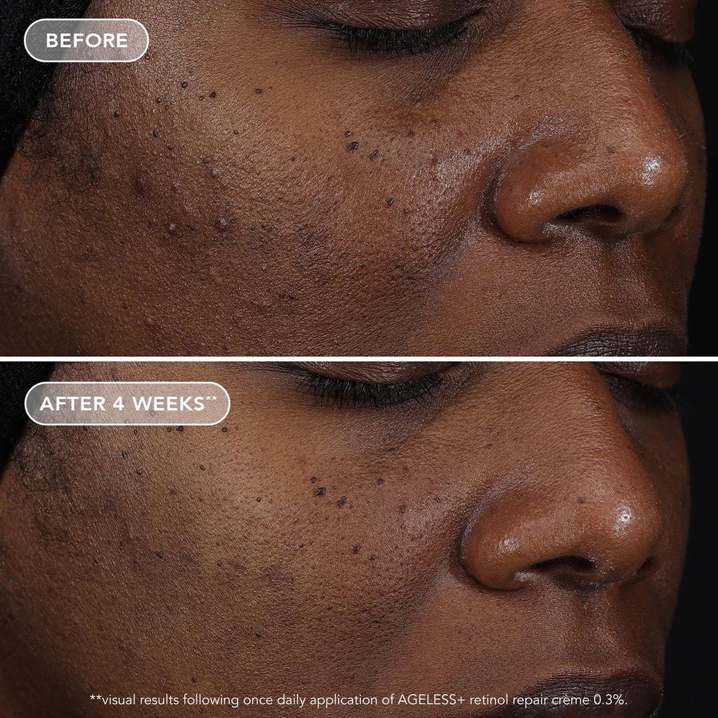 IMAGE Skincare, AGELESS+ retinol repair crème 0.3% retinol complex, 1.7 oz