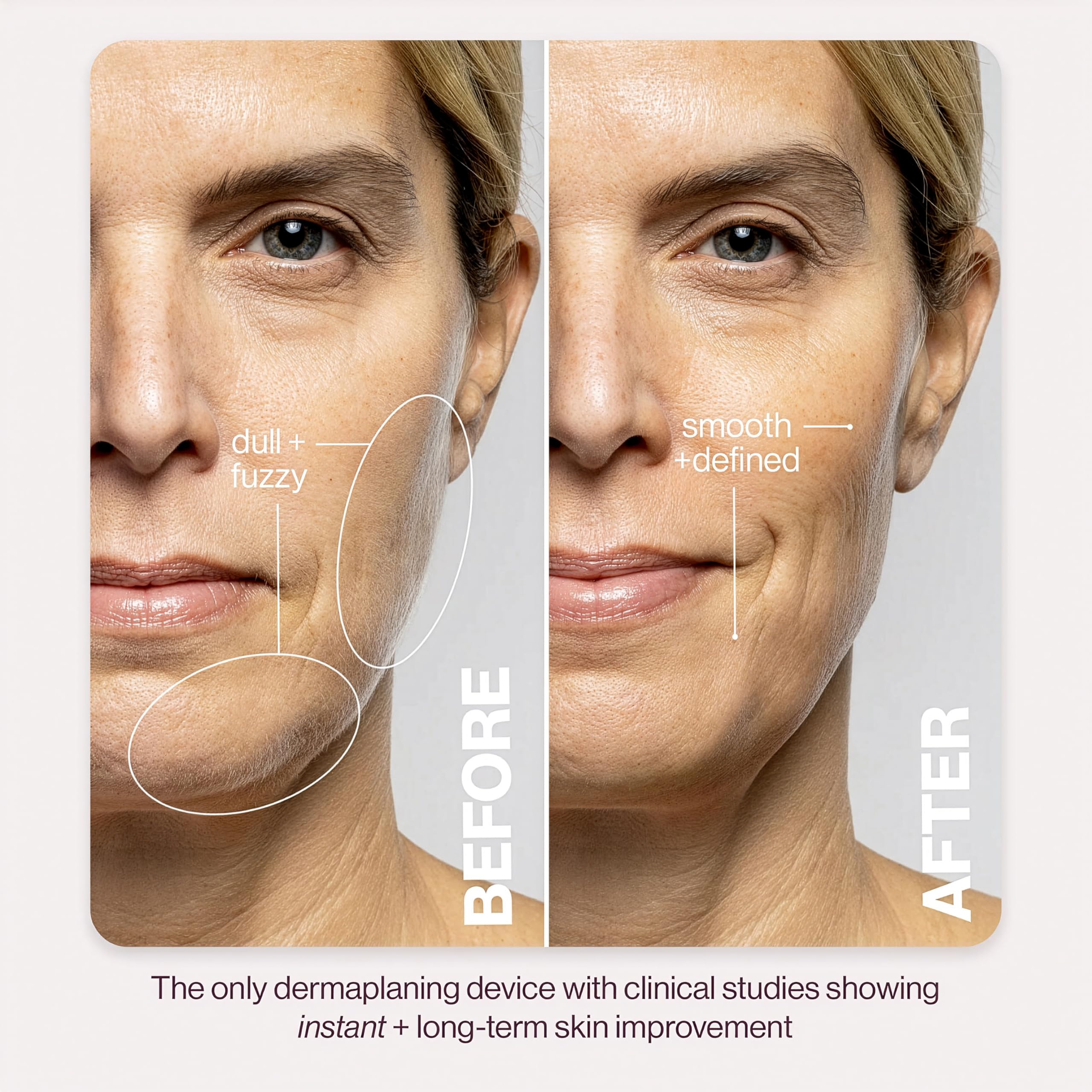 DERMAFLASH LUXE+ Sonic Dermaplaning Tool for Face Peach Fuzz Removal, Anti-Aging and Exfoliation