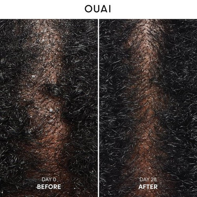 OUAI Anti Dandruff Shampoo - Soothing Salicylic Acid Formula for Flaky Scalp - Reduces Itching & Irritation - 10 Fl Oz