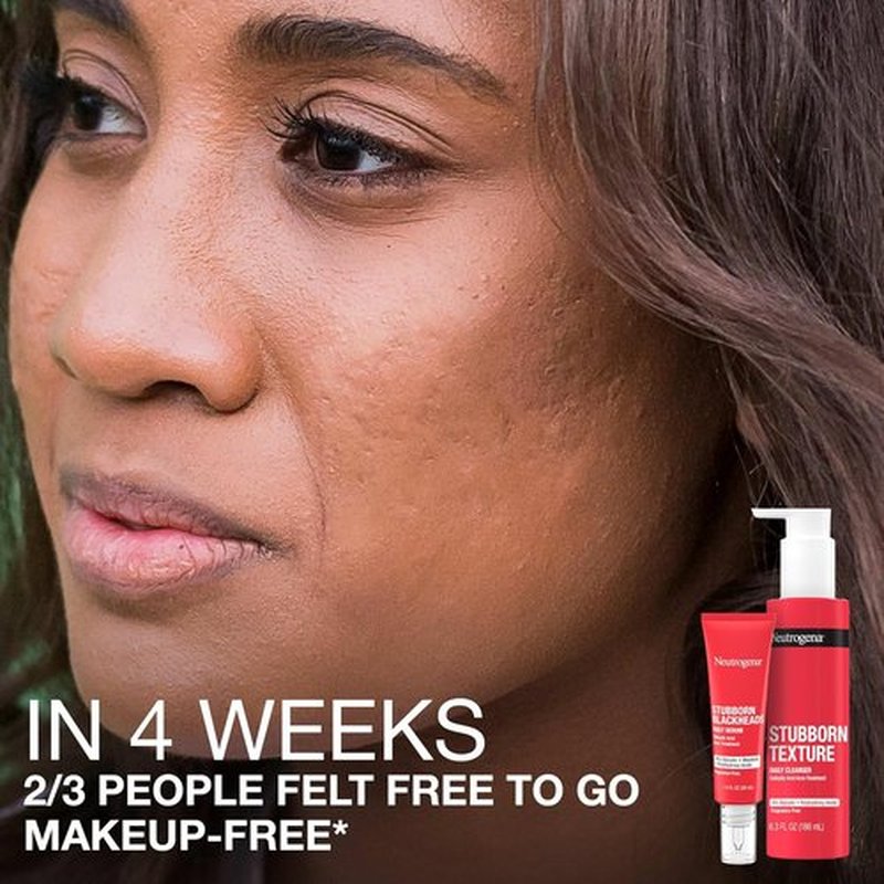 Neutrogena Acne Facial Serum - Daily Treatment for Stubborn Blackheads | Oil-Free, 1 fl. oz