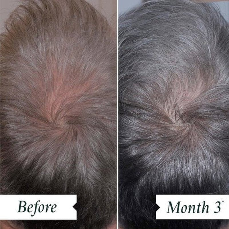 Philip Kingsley Density Preserving Serum - Thinning Hair Treatment for Scalp Care | 2.87 oz