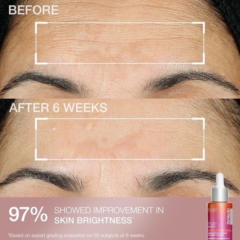 StriVectin Skin Care Holiday Gift Kits - Brightening, Smoothing & Hydrating Beauty Sets for Radiant Skin