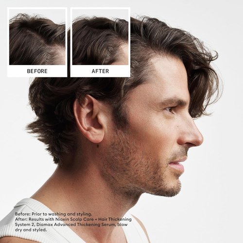 Nioxin Scalp + Hair Thickening Conditioner - Niacinamide & Biotin for Thinning Hair | 33.8 Fl Oz