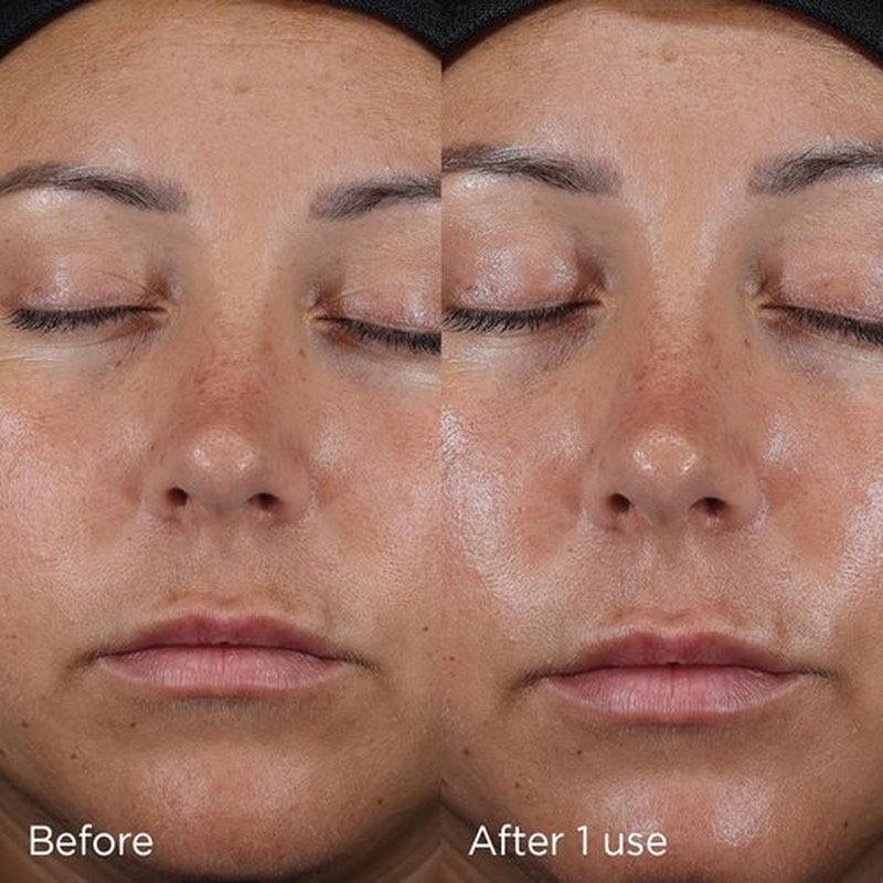 IMAGE Skincare Daily Prevention Ultra Defense Moisturizer - SPF 50 Broad Spectrum Sunscreen, Fragrance-Free