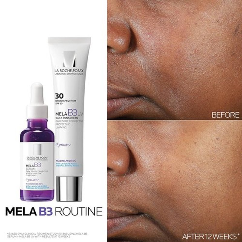 La Roche-Posay Mela B3 Serum - Dark Spot Corrector with 10% Niacinamide for Age & Sun Spots