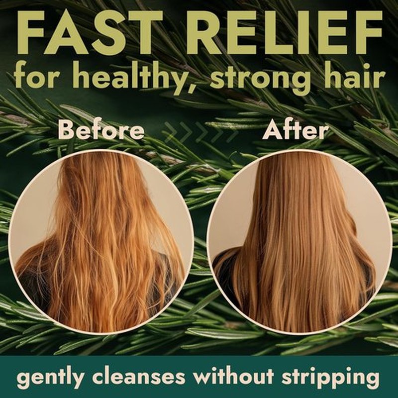 Regine Switzerland Rosemary Shampoo & Conditioner Set - Scalp Relief & Hair Growth | Sulfate-Free, Soothes Dry Scalp + Free Scalp Brush | 16.9 fl oz