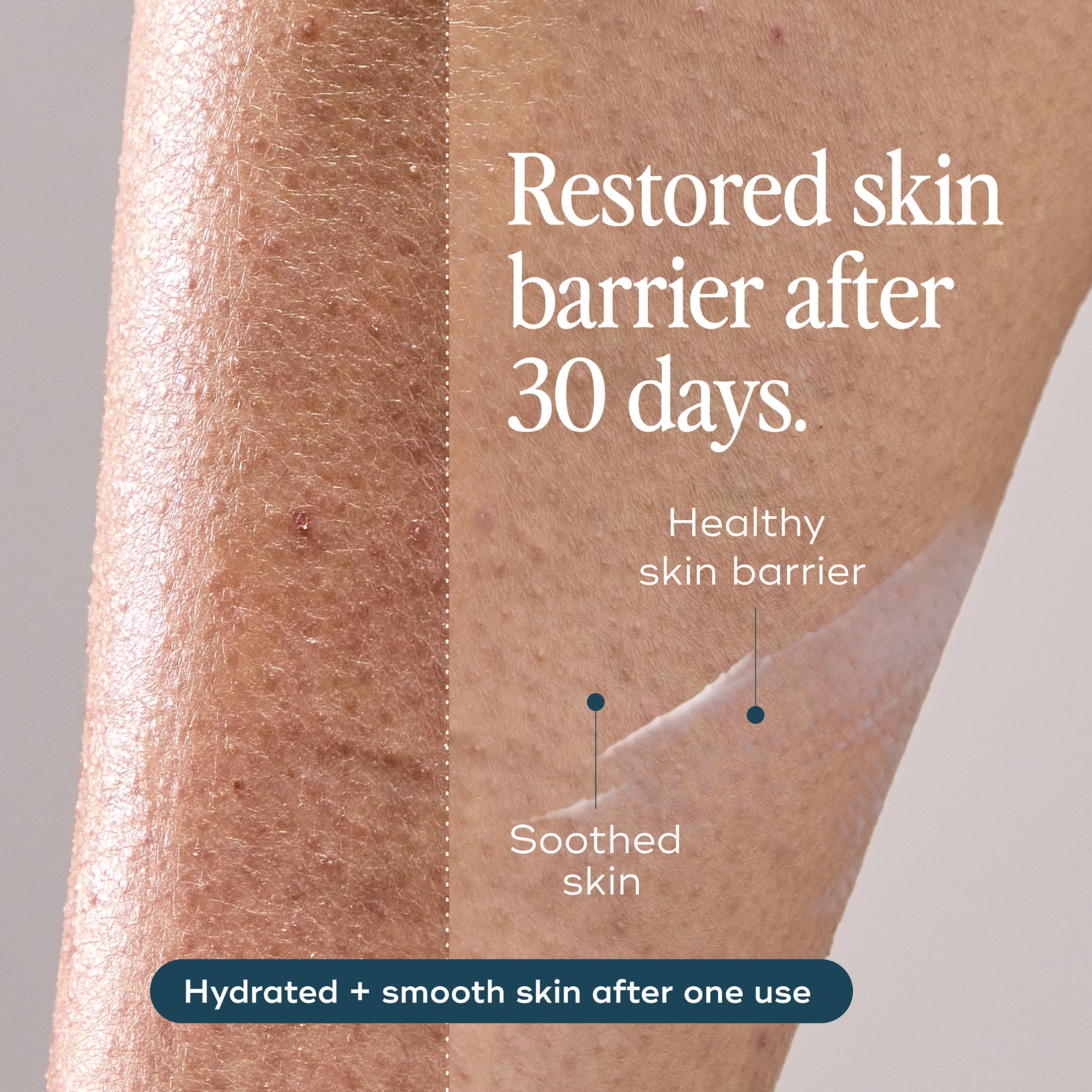 Luna Daily Body Lotion for Dry & Sensitive Skin | Hydrating, Barrier-Supporting Daily Moisturizer | With Niacinamide, Shea Butter, Prebiotics & Postbiotics | Nourishes, Firms & Soothes