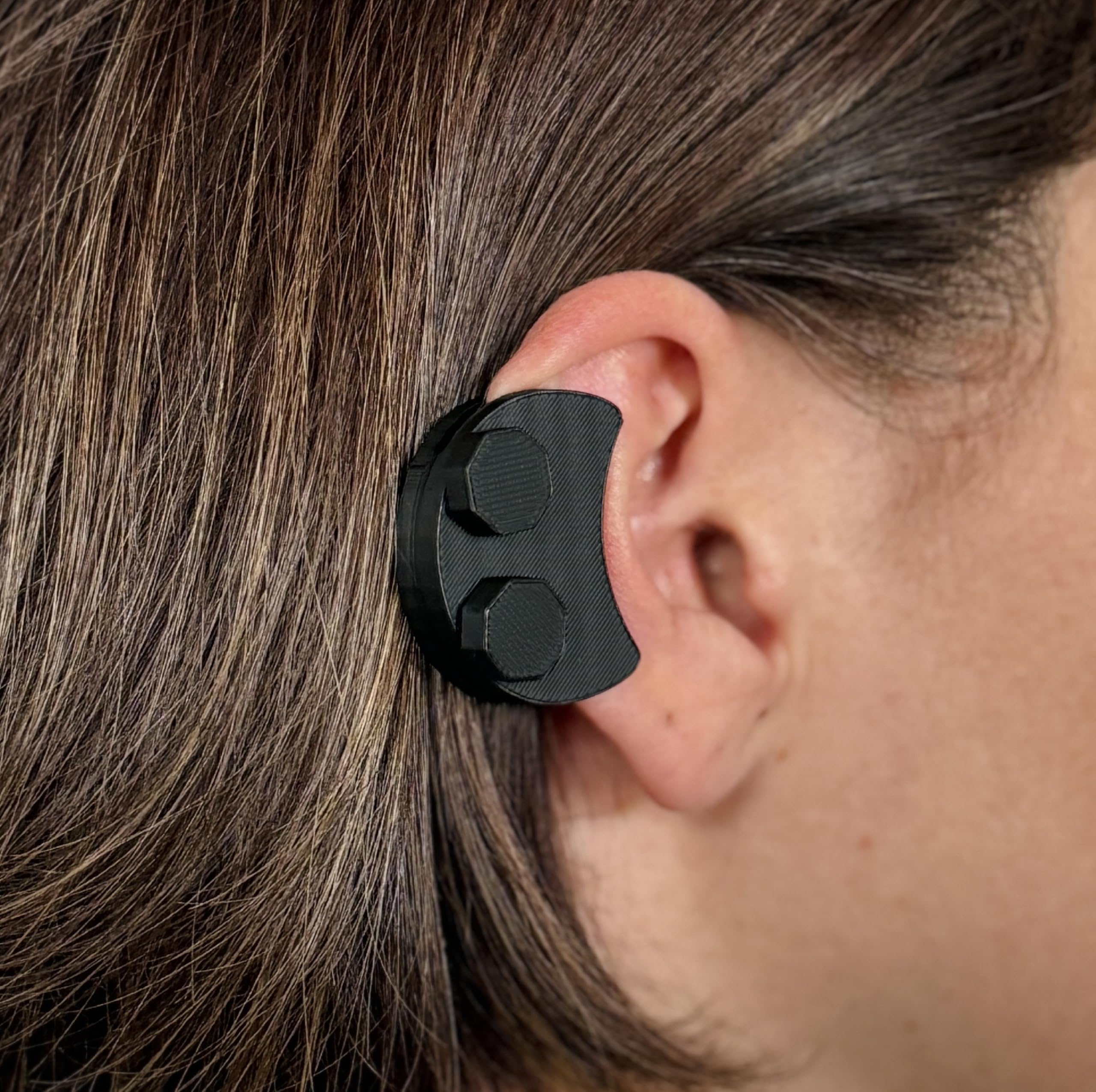 Keloid Compression Earring – Clinically Designed Medical Pressure Helix Earlobe for Ear Keloid Removal, Post-Surgery Healing & Scar, Wound Treatment