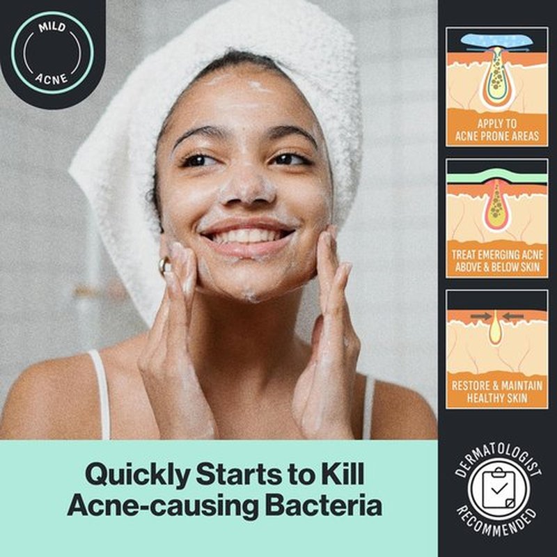Oxy Acne Cleanser for Sensitive Skin - Gentle Formula for Clear Complexion | 6 oz