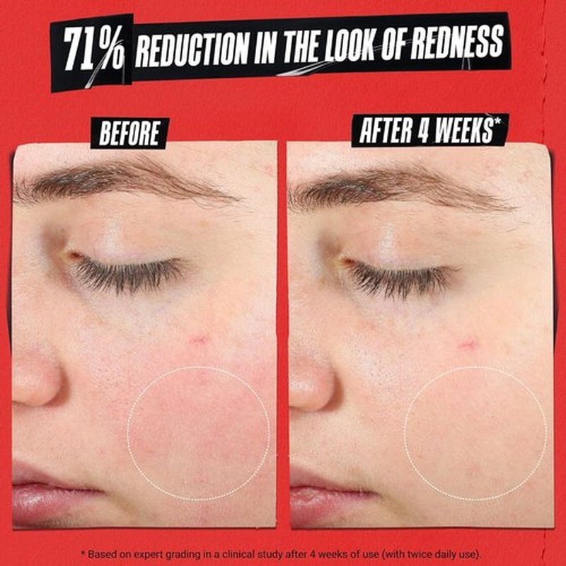 Kiehl's Ultra Facial Recovery Barrier Cream - Lightweight Moisturizing Lotion for Dry & Sensitive Skin