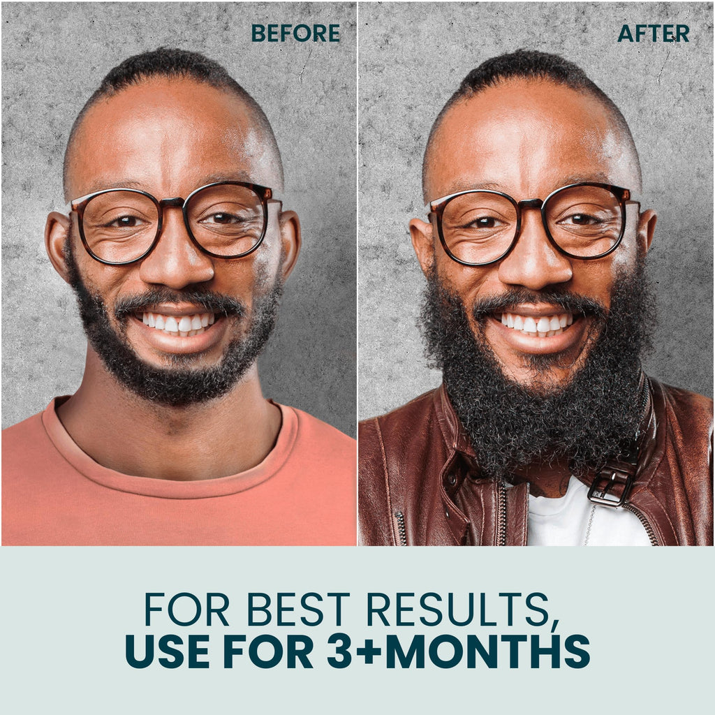 Beard Oil for Black Men with Sensitive Skin - Beard Conditioner, Softener & Moisturizer for Black Men - Made with Vitamin E & Grapeseed Oil, Unscented, Natural & Organic, Doesn’t Clog Pores 2oz