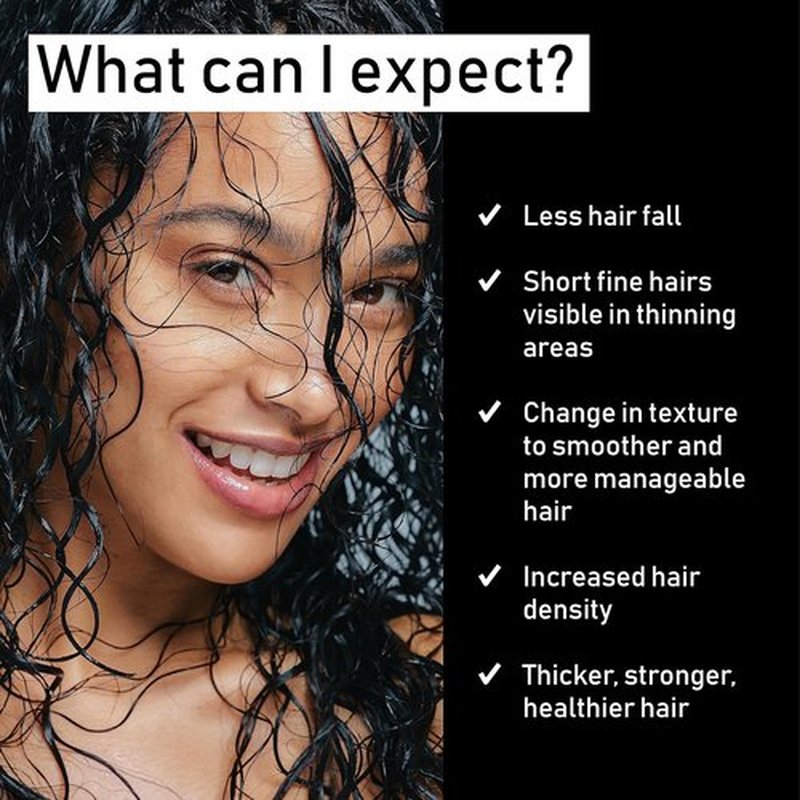 EVOLIS Promote Scalp Activator - Hydrating Scalp Serum for Stronger Hair Growth | 1.7 fl oz