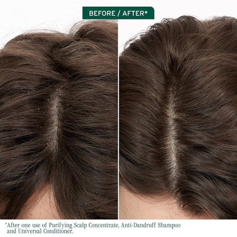 Biolage Scalp Sync Anti-Dandruff Shampoo - Moisturizing Treatment for Itchy Scalp with Zinc Pyrithione | 1.7 FL Oz