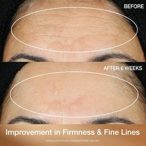 StriVectin Multi-Action Super C Retinol Serum - Brightening & Correcting Formula for Radiant Skin