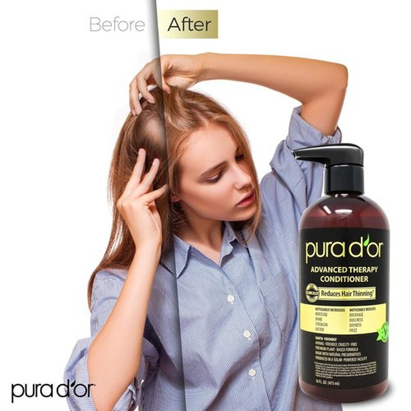 PURA D'OR Advanced Therapy Conditioner - Moisture, Strength & Volume Boost | 16oz, Sulfate-Free, Argan Oil & Biotin for All Hair Types