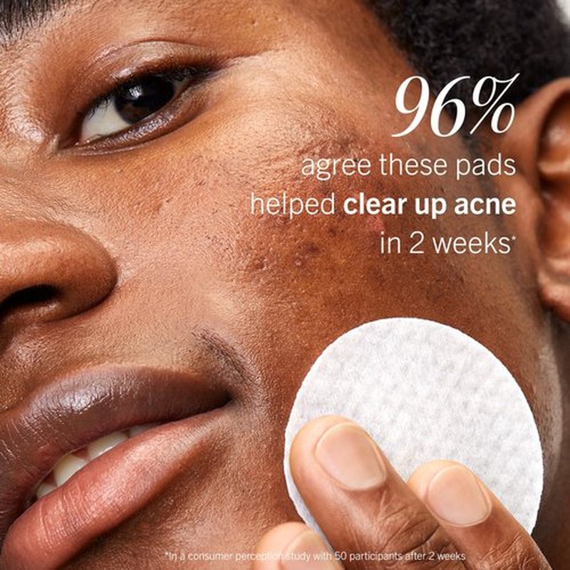 First Aid Beauty Acne Pads for Face - Maximum Strength Acne Treatment - 2% Salicylic Acid Pads Treat Without Drying, (60-ct)