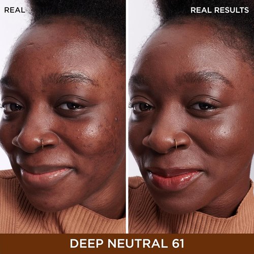 IT Cosmetics Bye Bye Dark Spots Concealer & Brightening Serum - 2% Niacinamide, Hyaluronic Acid, Caffeine - Medium Coverage, Natural Finish, 0.22 fl oz