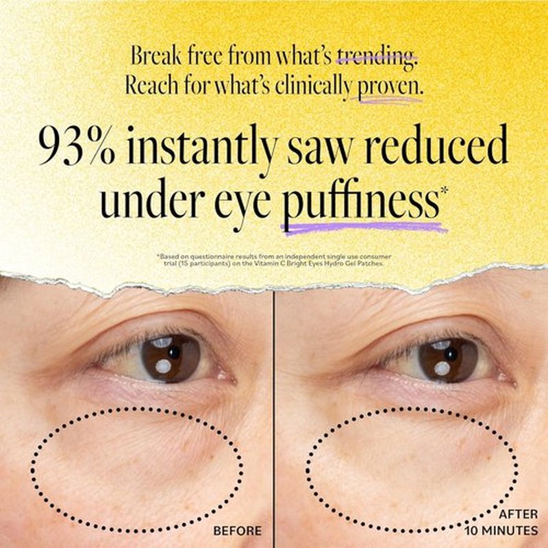 Derma E Vitamin C Hydro Gel Eye Patches - Brighten Dark Circles & Reduce Puffiness (10 Ct, 5 Pairs)